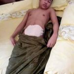 Butuh Uluran Tangan, "TOMI" Seorang Pelajar warga Desa Lambai menderita Usus Buntu Menahun